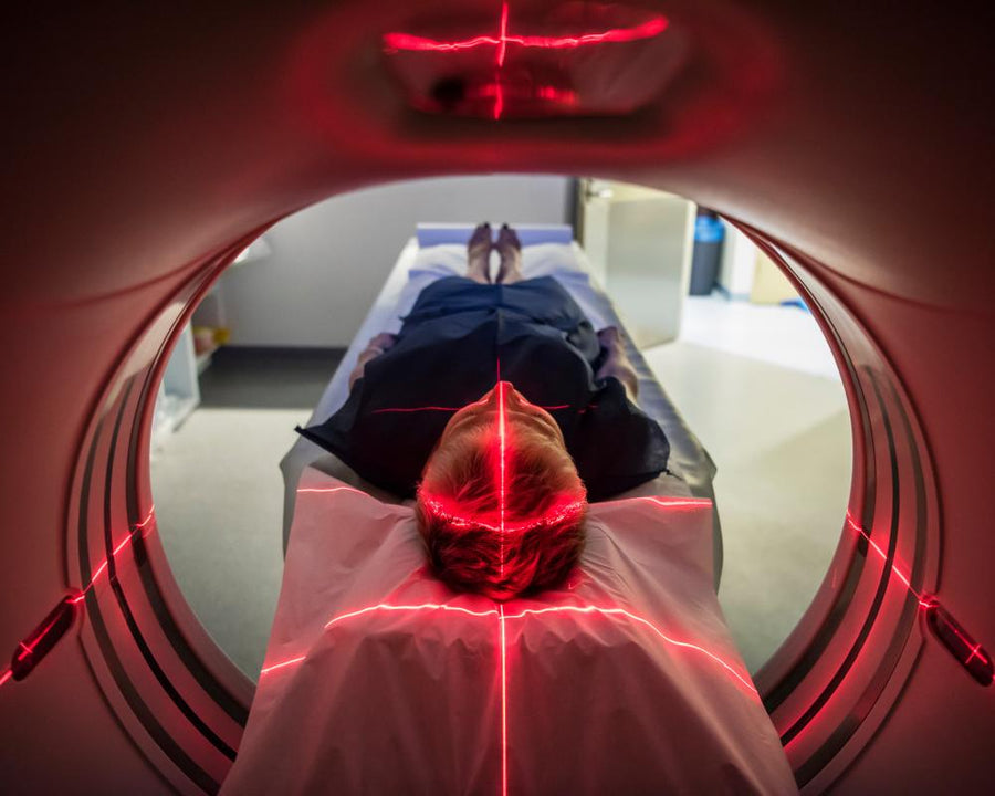 Early Onset Cancer Rise: Why Younger Generations Face Higher Risk