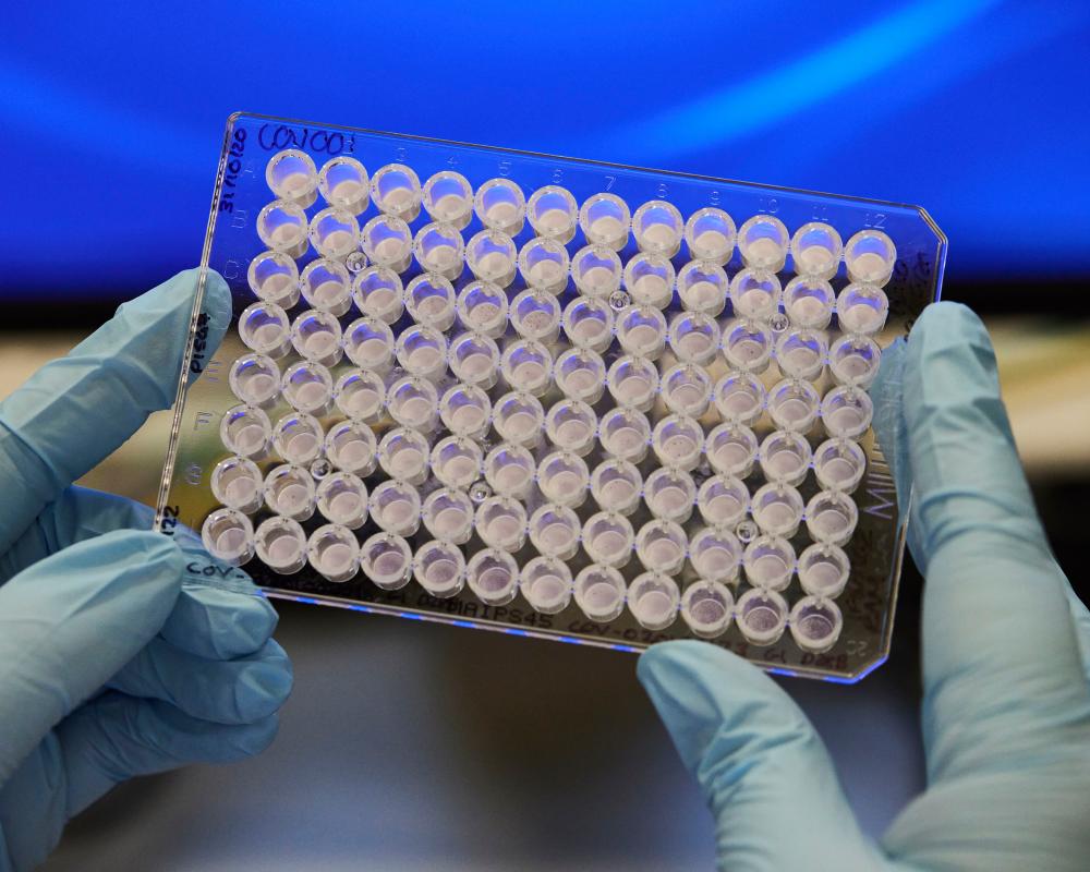 AstraZeneca BMS Merger Talks: $400B Pharma Deal Analysis