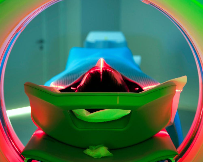 Cancer Rates Rising Faster in Younger People, Study Finds
