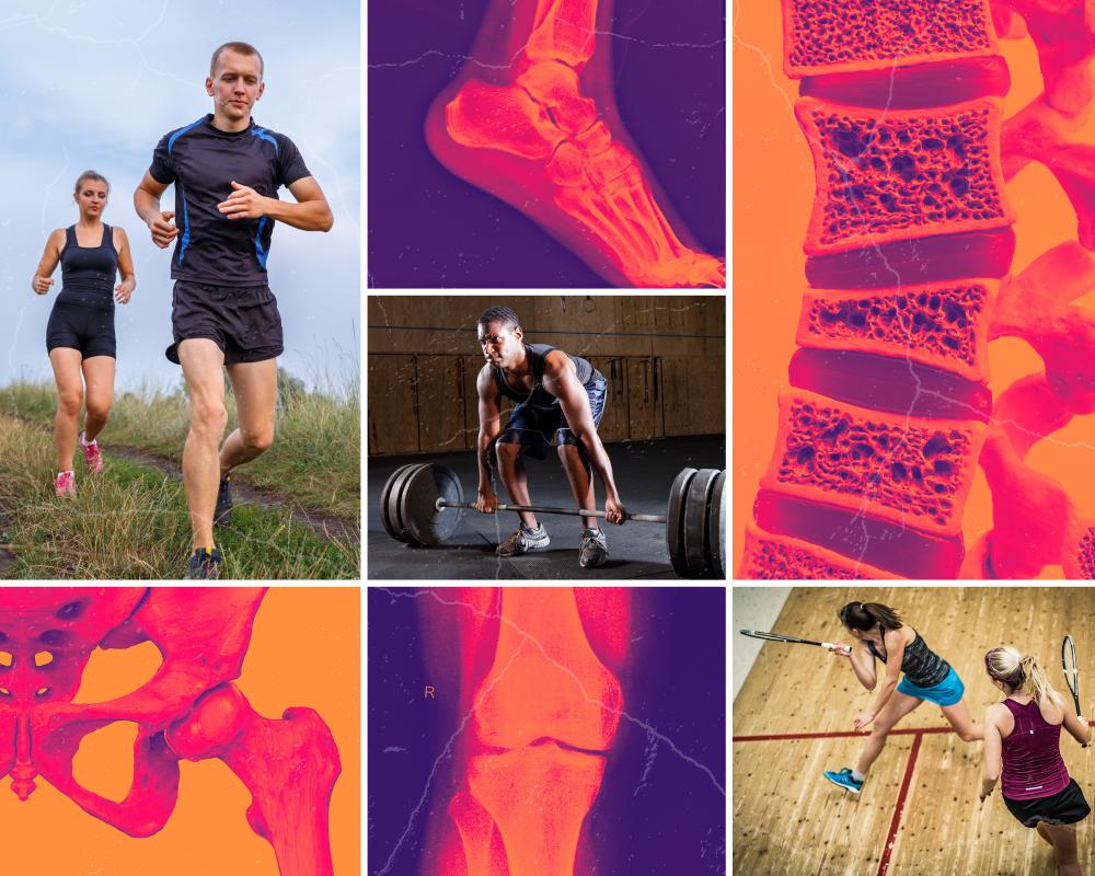 Why Fitness Fans Need Joint Surgery: Overuse Injuries Explained