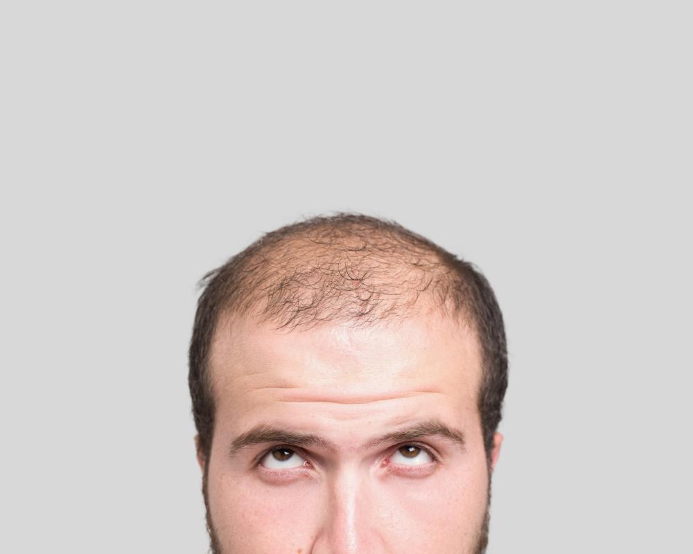 20 Fascinating Hair Facts: Baldness, Pubic Hair, and Evolution