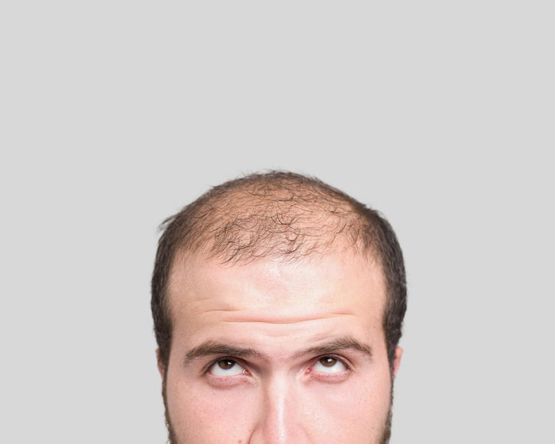 20 Fascinating Hair Facts: Baldness, Pubic Hair, and Evolution