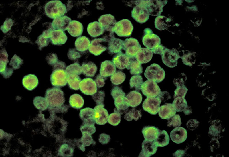 Brain-Eating Amoeba Claims Life of NC Teen: What You Need to Know