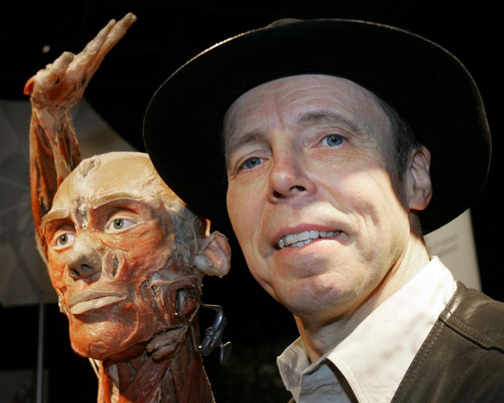 Gunther von Hagens Dies at 81: Body Worlds Creator's Plastination