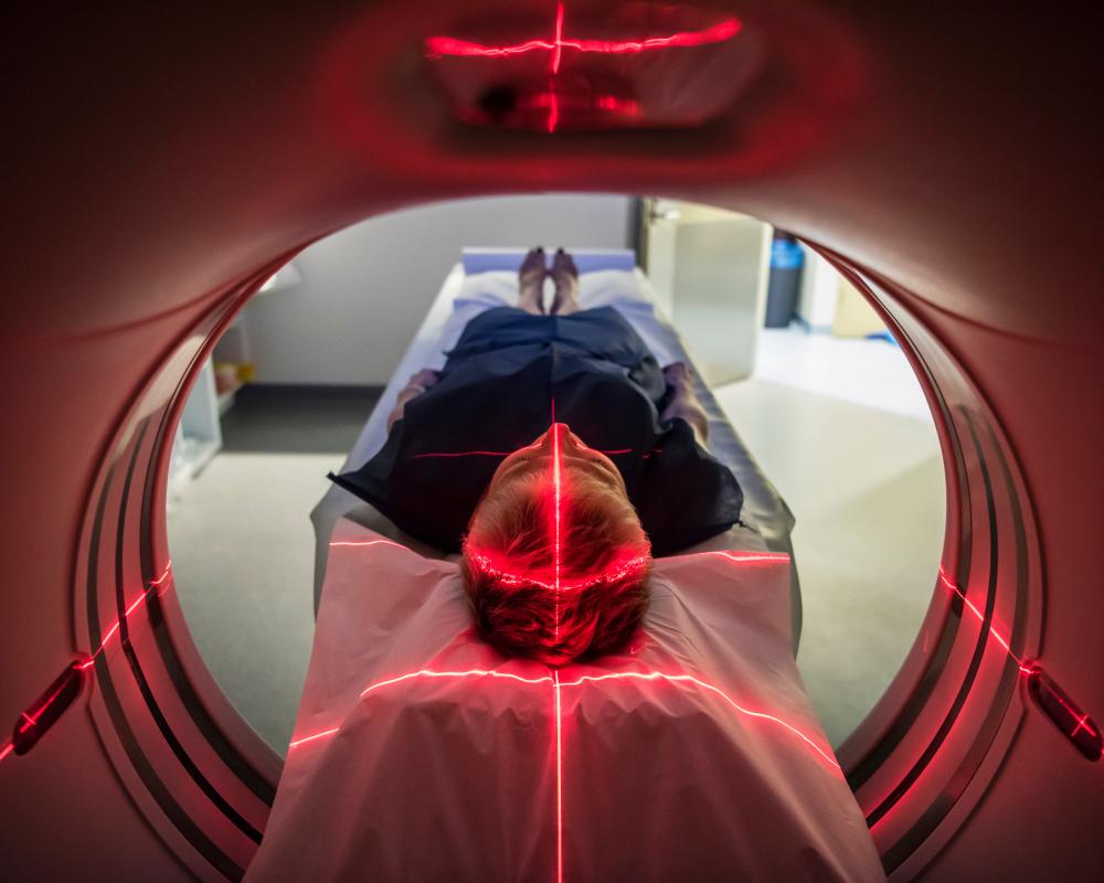 Early Onset Cancer Rise: Why Younger Generations Face Higher Risk