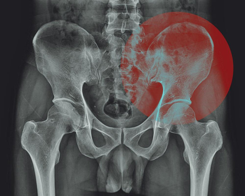 Do Hips Really Hold Tension? The Truth About Stress and Hip Tightness
