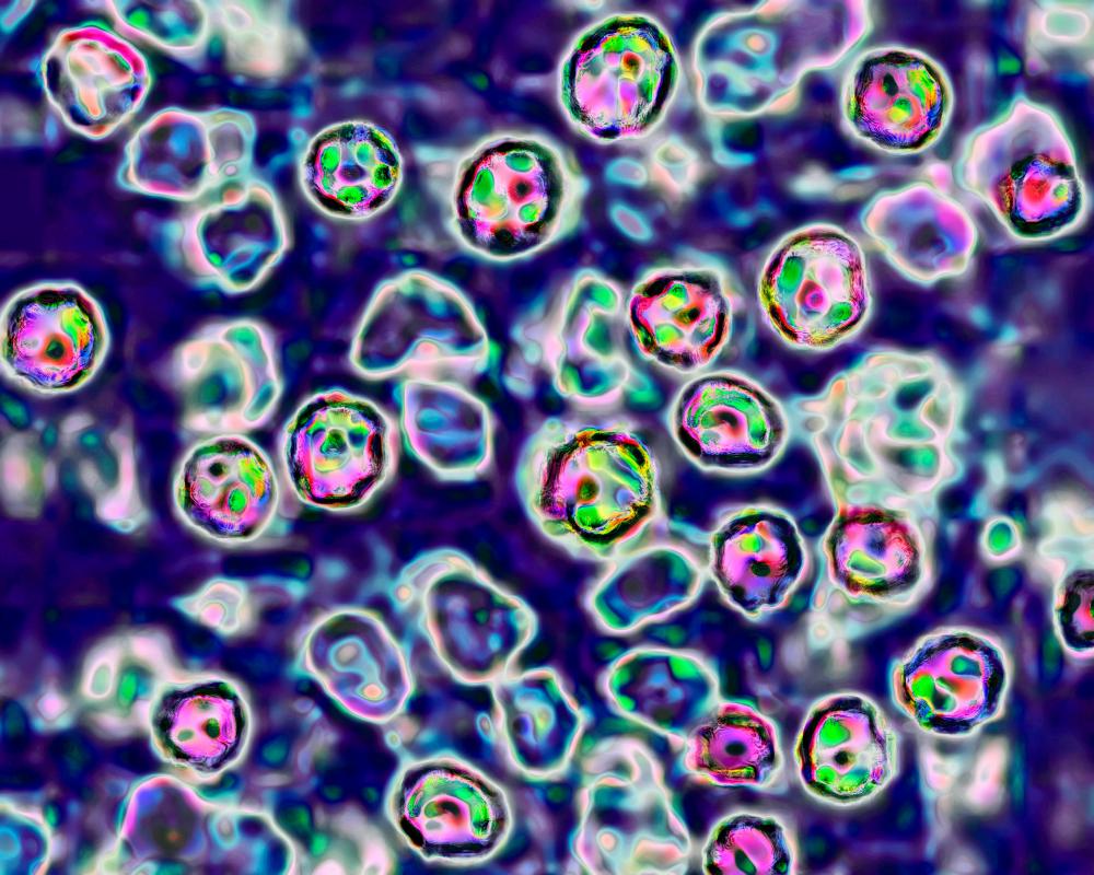 Measles Deaths in Pennsylvania Highlight Vaccine Urgency