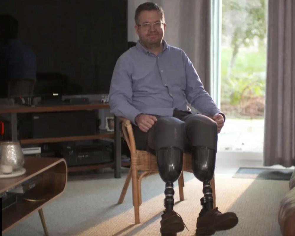 An Amputation Obsession Review: Disturbing Documentary Story