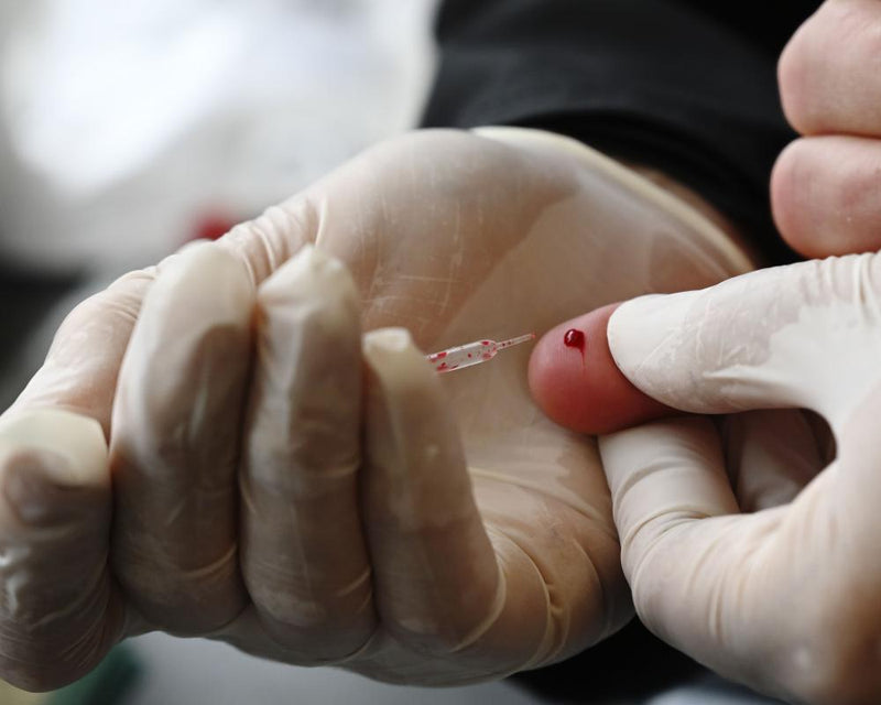 NHS Free Cholesterol Tests: A Five-Point Health MOT for Prevention