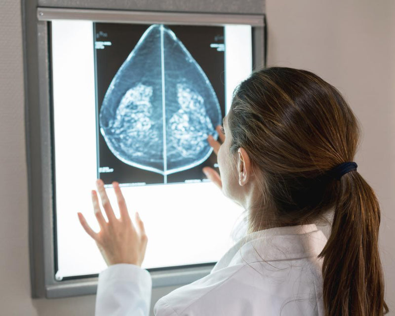 AI Mammogram Screening Detects Heart Disease in Women