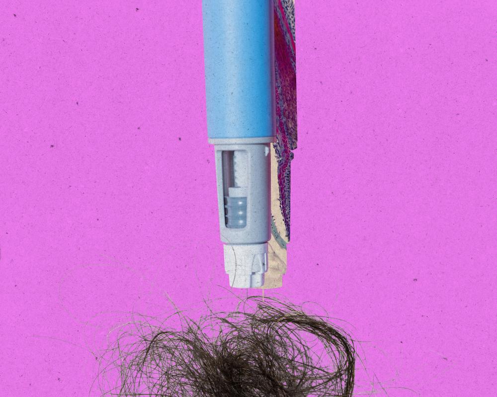 GLP-1 Hair Loss: Does Ozempic or Mounjaro Cause Shedding