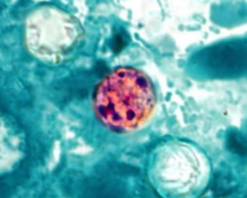 US Cyclosporiasis Outbreak Kills Two in Michigan: Key Facts