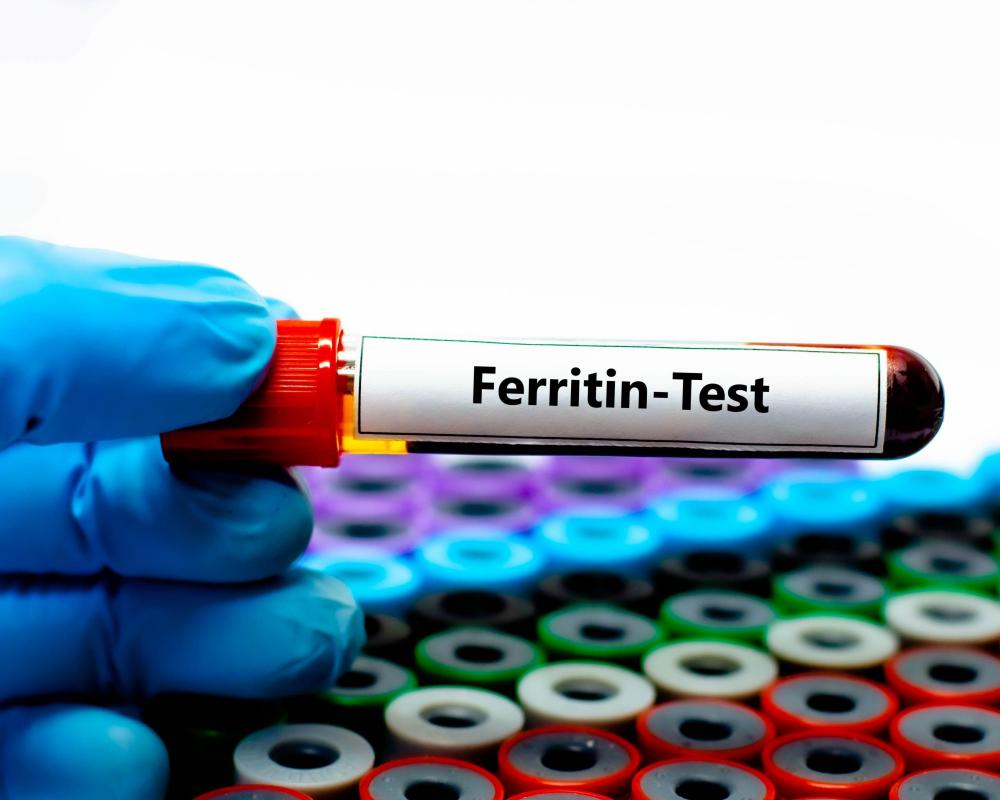 Ferritin Face: Separating Iron Deficiency Fact From Fiction