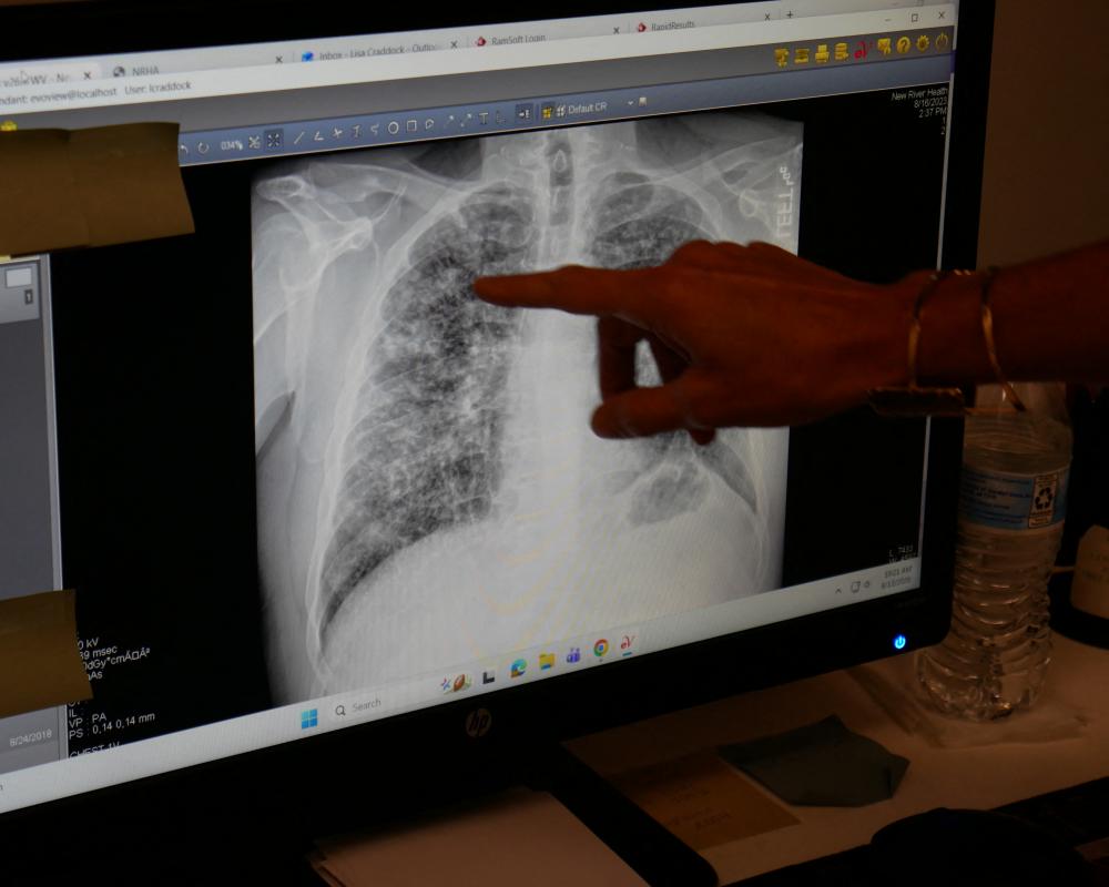 Black Lung Prevention: Why Workers Are Still Dying Today