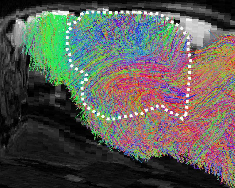 Part-Human Brains: Scientists Create Mice for Brain Disorder Research