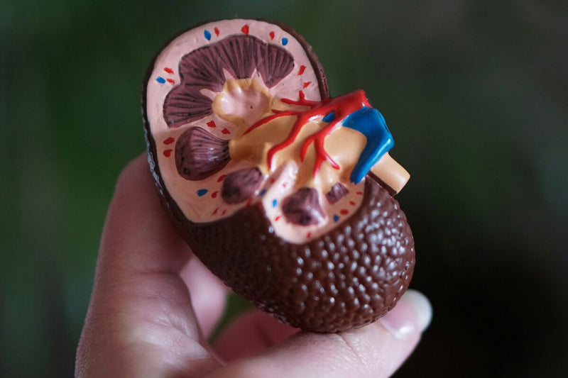 Pig Kidney Transplant Sets Record: 271 Days Without Dialysis