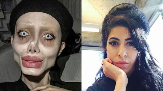 30+ Celebrities with Extreme Plastic Surgeries Grand Goldman