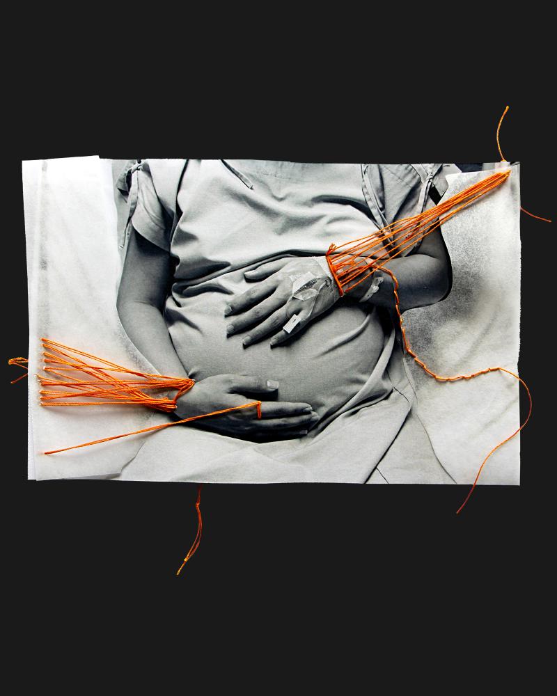 Shackling During Childbirth in Australia: A Last Resort or Routine