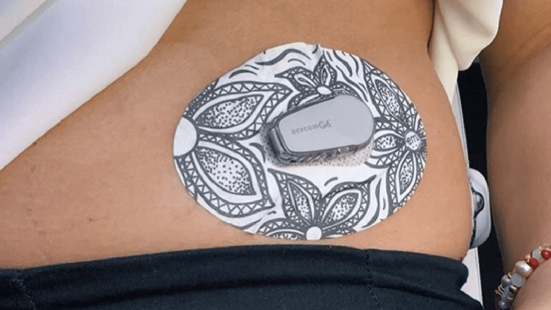Best Dexcom G6 Patches for Sensitive Skin - Grand Goldman