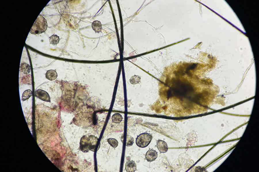 Scabies Pest Control: Complete Guide to Eliminate Mites