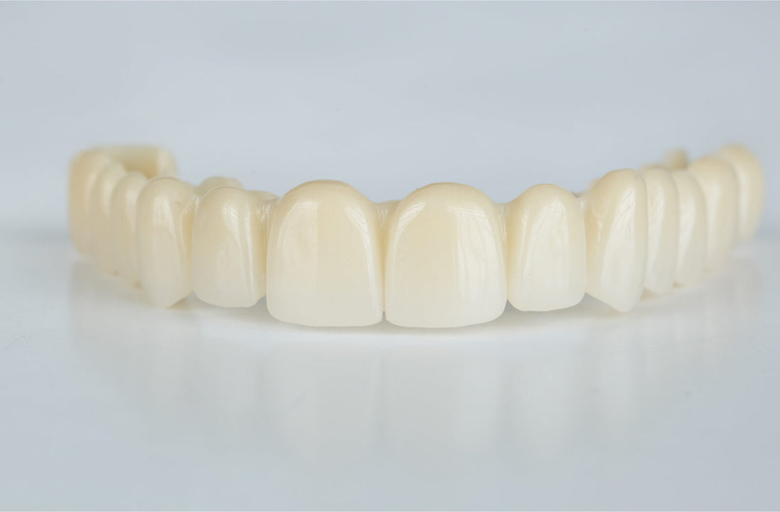 10 Best Temporary Veneers for a Natural, Affordable Smile Fix - grandgoldman.com