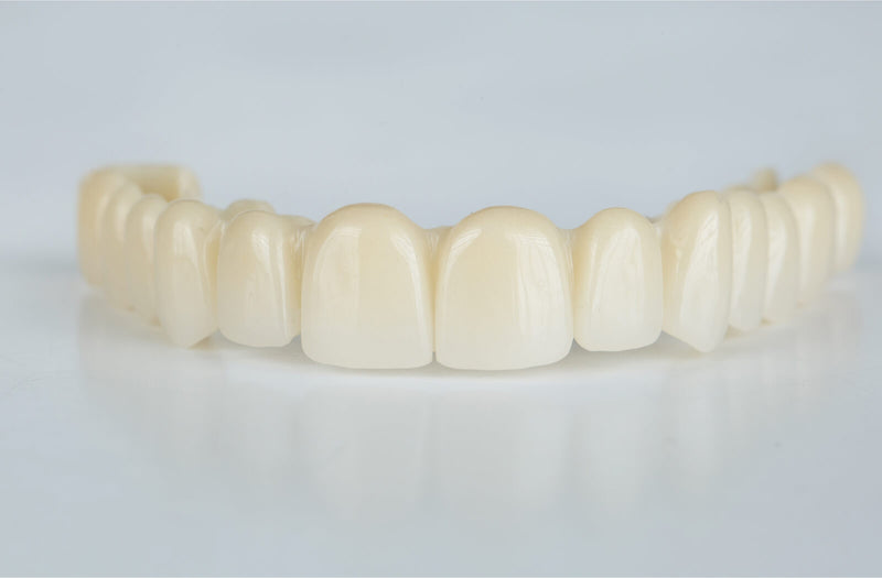 10 Best Temporary Veneers for a Natural, Affordable Smile Fix - grandgoldman.com