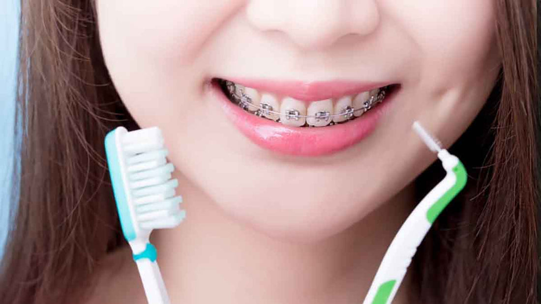 Best Toothpaste for Braces - Grand Goldman